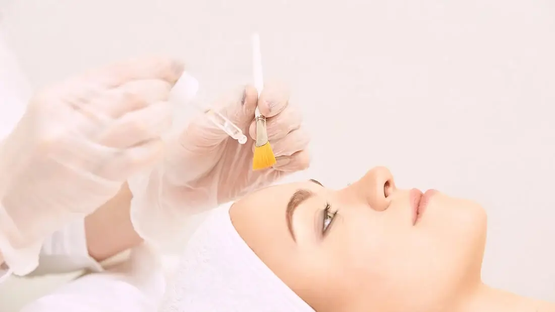 Chemical Peel. Facial treatments chemical peel treatment