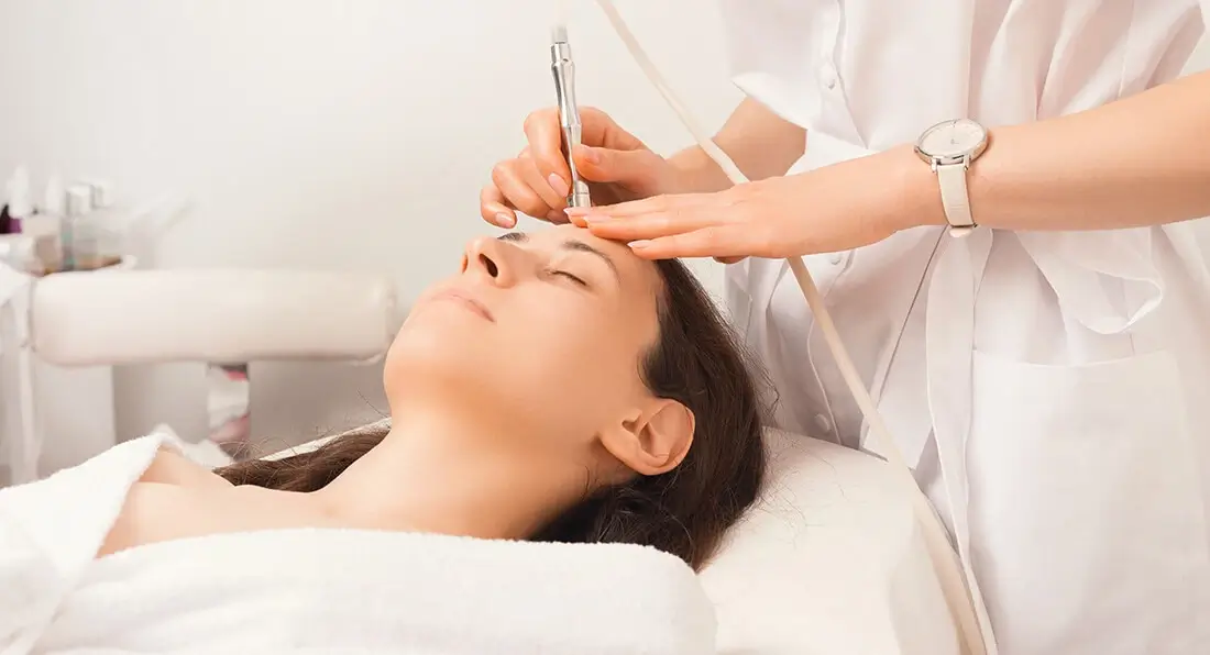 Microdermabrasion treatment