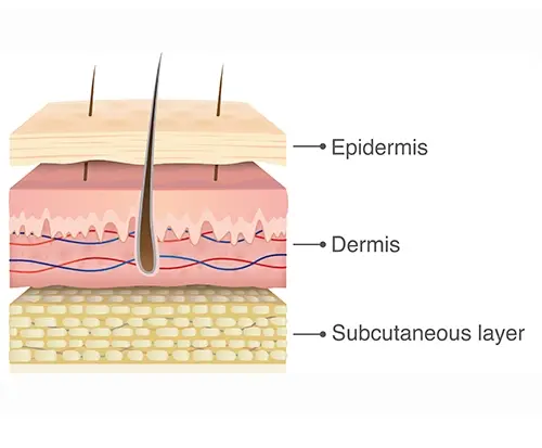 epidermis, dermis, subcutaneous layer