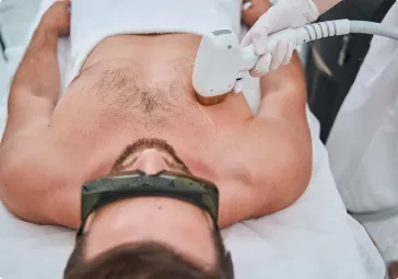 Laser Chest Hair Removal image