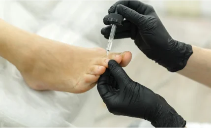 Une personne recevant un traitement des pieds avec une aiguille, illustrant un soin de manucure et pédicure.