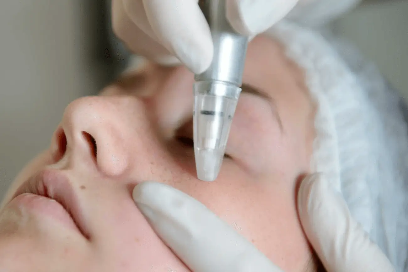 microdermabrasion-chemical-peel-which-is-right-for-me img