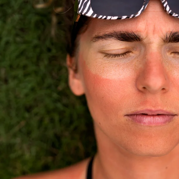 Femme portant des lunettes de soleil, mettant en avant des thèmes de collagène et d'élastine.